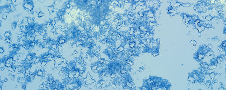 Frost pattern on winter glass. Ice texture on the window. Abstract natural background. Social media...