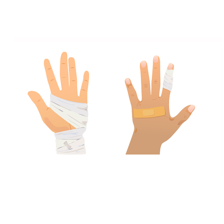 Injured vector front and back hands on white background.のイラスト素材