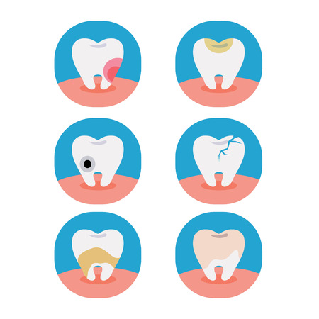Vector of six problem of tooth on white background.のイラスト素材