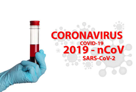 Coronavirus Covid-19. Laboratory blood test in a flask on white background. SARS-CoV-2の写真素材