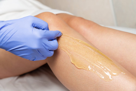 Foot shugaring procedure in a beauty salon. A gloved master applies sugar paste on a woman's leg for...