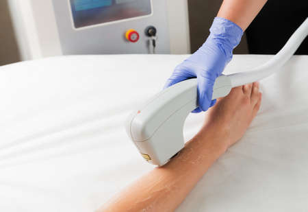 Laser hair removal of hands in a beauty salon using laser hair removal technology.の写真素材