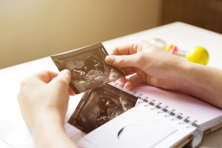 Woman placing baby's sonogram into baby's first year memory bookの写真素材