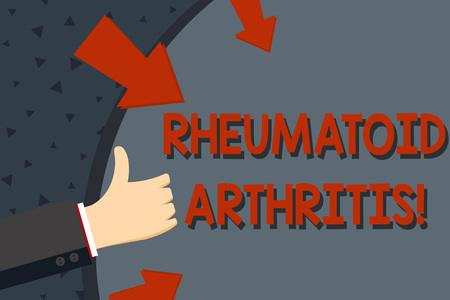 Text sign showing Rheumatoid Arthritis. Business photo text chronic progressive disease causing joints inflammation Hand Gesturing Thumbs Up and Holding on Blank Space Round Shape with Arrowsの写真素材