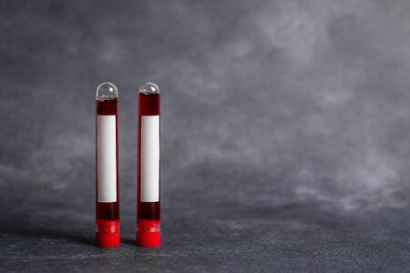 Extracted Blood Sample Vial With Medical Accessories Ready For Examinationの写真素材