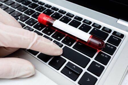Extracted Blood Sample Vial With Lastest Technology Ready For Examination