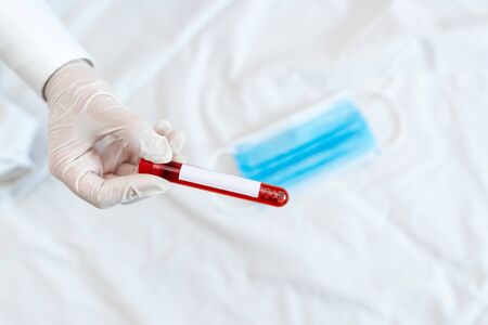 Extracted Blood Sample Vial Ready For Medical Diagnostic Examination