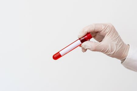 Extracted Blood Sample Vial Ready For Medical Diagnostic Examination