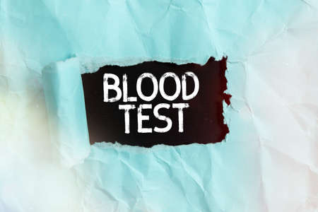 Handwriting text Blood Test. Conceptual photo Extracted blood sample from an organism to perfom a...