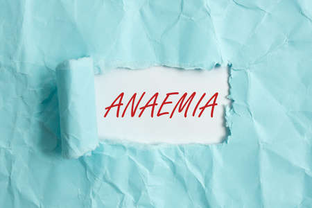 Text sign showing Anaemia. Business photo showcasing a condition marked by a deficiency of hemoglobin in the blood Rolled ripped torn cardboard placed above a wooden classic table backdropの写真素材