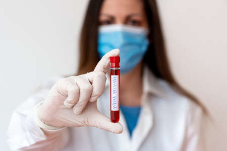 Word writing text Positive Result. Business photo showcasing shows that an individual has the disease, condition, or biomarker Laboratory blood test sample shown for medical diagnostic analysis resultの写真素材