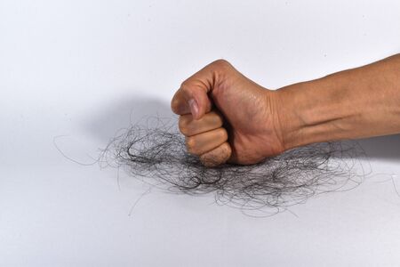 Hair loss problems are many