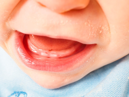 Baby boy showing first teeth with mouth wide open over blue bib