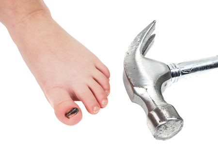 Child showing blue toenail barefoot next to shining steel hammer isolated on whiteの写真素材