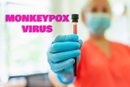 Monkeypox outbreak concept.Inscription monkeypox virus.Virus transmitted to humans from animals.Laboratory nurse holding a blood test.Selective focus,blurred background.の写真素材