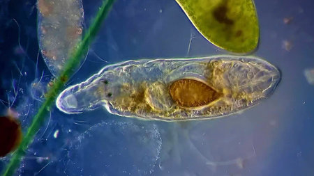 micro organism worm single cell under microscope