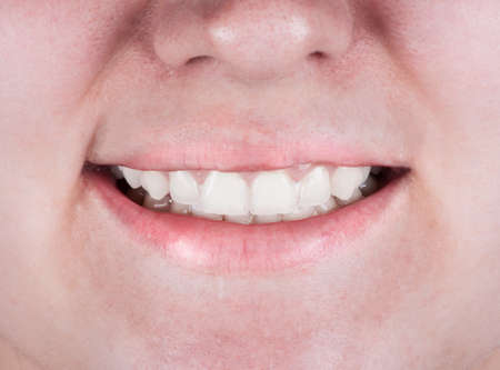 Beautiful young woman smile. Dental health.