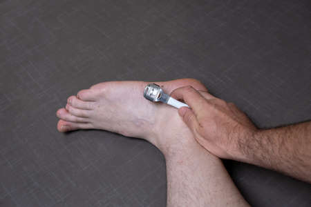 Man removing corn, callus from his feet using a razor file, masculine skin care, skin disease, fungal infection, skin treatment and healthcare, close up, caucasian, not recognizableの写真素材
