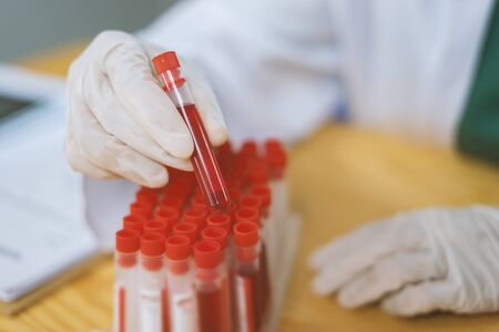 hand of a lab technician or medical doctor holding blood tube test and background a rack of color tubes  and microscope with blood samples other patients in laboratoryの写真素材