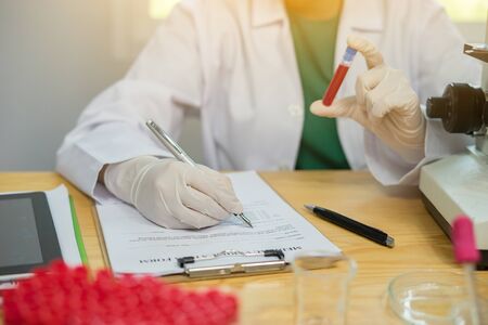 hands a medical doctor holding blood sample and making notes writing on prescription,lab technician hold blood tube test background of test tubes microscope blood samples other patients in laboratory の写真素材