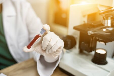 hand of a lab technician or medical doctor holding blood tube test and background a rack of color...