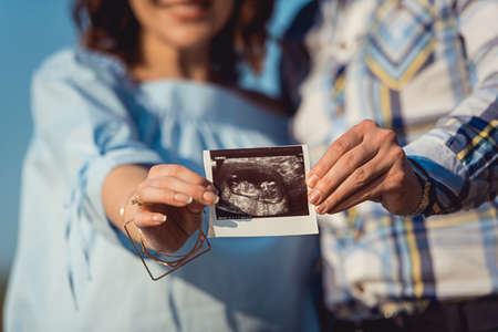 Pregnant couple holding ultrasound scan. Concept of Pregnancy health care
