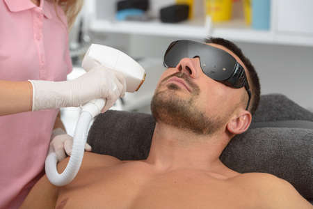 Laser hair removal on mans face. man in a goggles.の写真素材