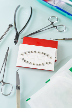 Orthodontic typodont with metal braces and mini screws tooth extraction treatmentの写真素材