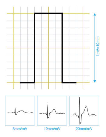 When 1mV voltage is input to different ECG calibration voltage, the amplitude of ECG deflection is different. This is an important parameter for analyzing ECG amplitude.の写真素材
