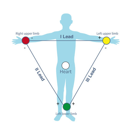 Einthoven triangle assumes that the left upper limb, right upper limb and left lower limb form an equilateral triangle, and the heart is located at the center of the triangle.の写真素材