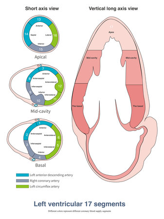 The left ventricle is divided into 17 segments, and different coronary arteries provide blood supply...