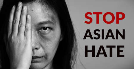 stop Asian hate campaign. Asia woman with bruise on arms and face, raise one hand and cover one face side. word stop Asian hate at copy space for poster of campaign.の写真素材