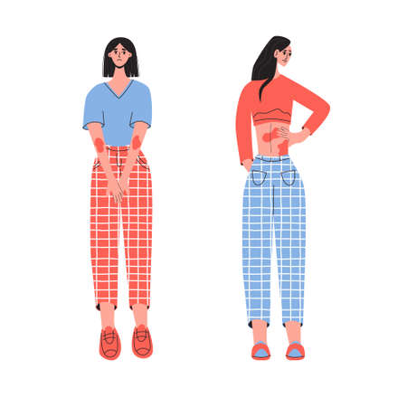 Two woman suffering from eczema and feelling pain. Flat vector illustration. Healthcare, pain, sickness, disease concept.のイラスト素材
