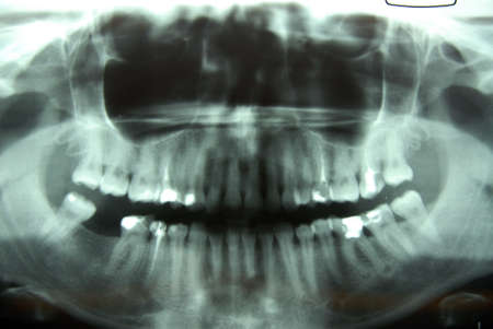x-ray 