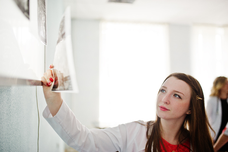 Portrait of a doctor looking at x-ray image of her patient's body part.の写真素材