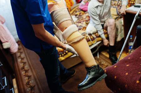 The prosthetist removes the measure from a person with a disability, man with amputee.