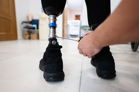 A close-up image of a technician using a tool to adjust a prosthetic leg in a clinical setting, ensuring comfort and mobility for the wearer.の写真素材