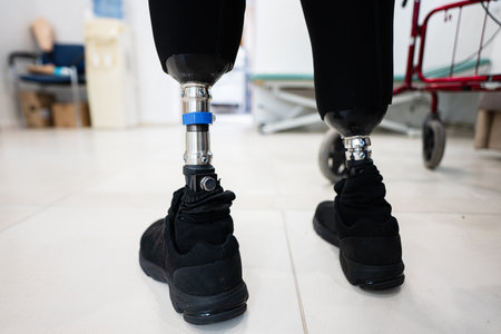 A detailed view of prosthetic legs fitted with black athletic shoes, emphasizing mobility and modern prosthetic technology indoors.の写真素材