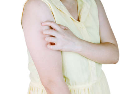 Woman scratching her arm
