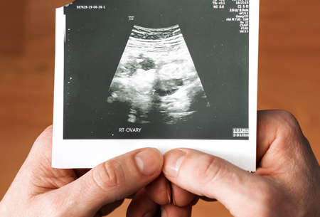 Close-up man's hands with ultrasound. Medical concept. Selective focusの写真素材