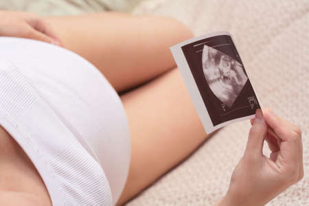 ultrasonic portrait of the fetus on background of the pregnant belly, echoの写真素材