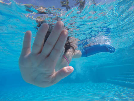 Unrecognizable brunette girl hiding face with palm hand while diving underwater in pool with arm in plasterの写真素材