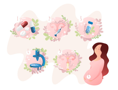 The stages of artificial insemination IVF. In vitro fertilization step-by-step methodのイラスト素材
