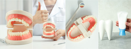 Collage of photos for Teeth treatment conceptの写真素材