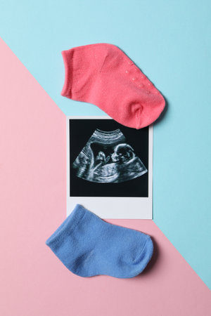 Concept of pregnancy and maternity, top view