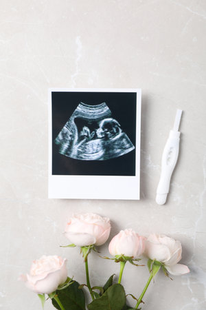 Concept of pregnancy and maternity, top viewの写真素材