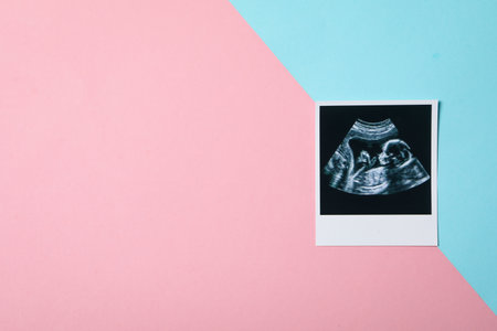 Concept of pregnancy and maternity, space for textの写真素材