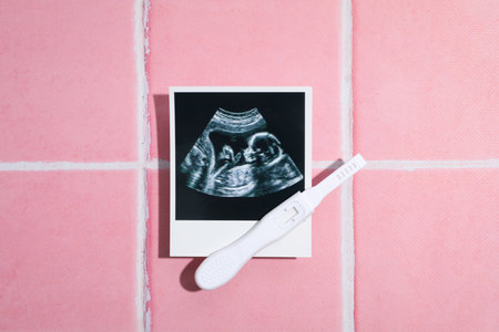 Concept of pregnancy and maternity, top viewの写真素材