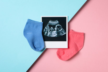 Concept of pregnancy and maternity, top viewの写真素材