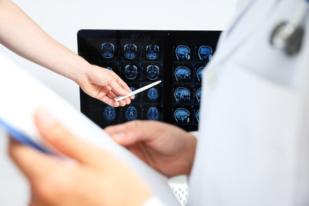 Doctors look at MRI images of a human headの写真素材